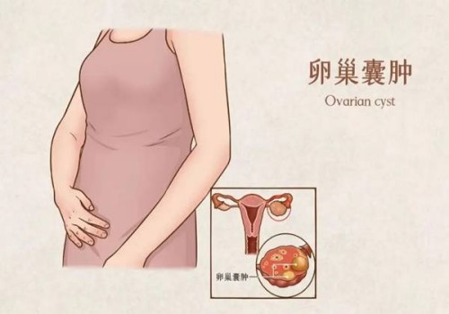 导致胎停的因素有哪些？孕妇的体温过低会导致胎停吗？