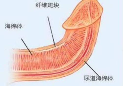 子宫畸形导致原因有两点，是否能正常生育还需根据你身体情况