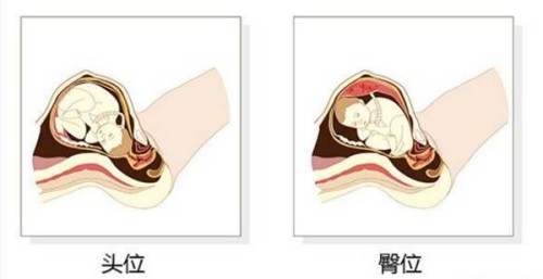 想去柬埔寨做试管怀双胞胎的女性需要做什么准备呢？