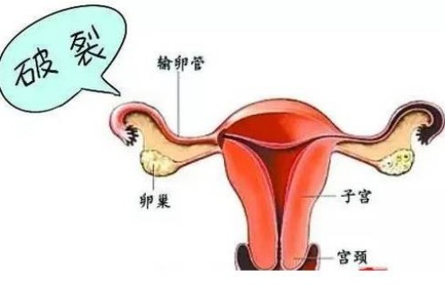 北京试管婴儿价格：做试管婴儿选什么医院好,具体要怎么选呢