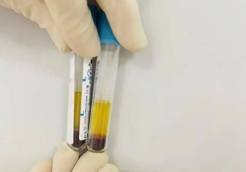 网上付费看B超准吗？孕期这些检查做了对宝宝健康发育挺好